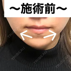 湘南美容クリニック 湘南美容クリニック 新宿本院口コミ