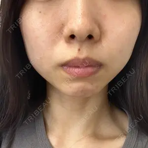 TCB東京中央美容外科 TCB東京中央美容外科 藤沢院口コミ
