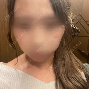 plume clinic plume clinic口コミ