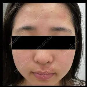 HINATA クリニック口コミ