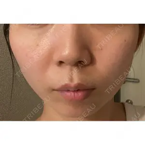 APスキンクリニック銀座口コミ