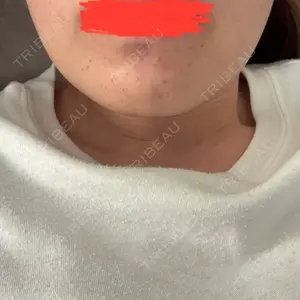 日本美容・医療クリニック 日本美容・医療クリニック 六本木院口コミ