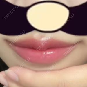 フィラークリニック フィラークリニック 名古屋栄院口コミ