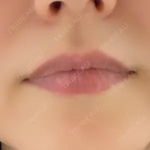 ルーチェクリニック ルーチェクリニック 銀座院口コミ