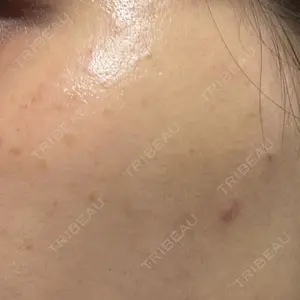 L‘amour clinic Tokyo【ラムールクリニック東京】口コミ