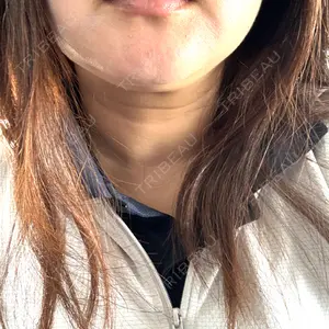 ミニマムスキンクリニック ミニマムスキンクリニック池袋口コミ