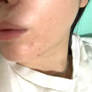 口コミ