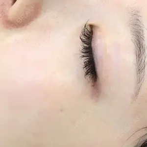 HINATA クリニック口コミ