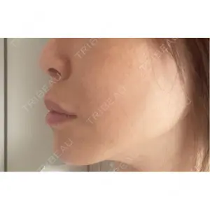 L‘amour clinic Tokyo【ラムールクリニック東京】口コミ