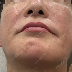 スマートスキンクリニック スマートスキンクリニック 神保町院口コミ