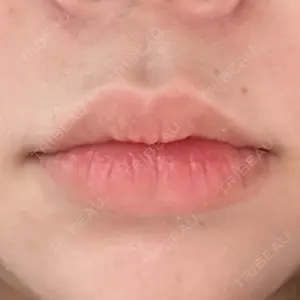 ルラ美容クリニック ルラ美容クリニック 新宿院口コミ