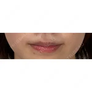 アリエル美容クリニック アリエル美容クリニック 横浜院口コミ