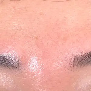 ゆきスキンクリニック 東池袋口コミ