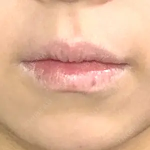 フィラークリニック フィラークリニック 大阪心斎橋院口コミ