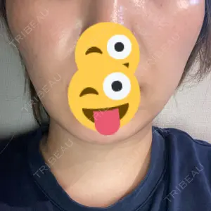 口コミ