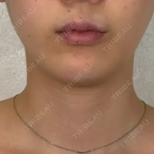 アリエル美容クリニック アリエル美容クリニック 横浜院口コミ