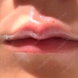 目白ホワイトクリニック口コミ