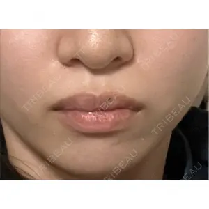 ルラ美容クリニック ルラ美容クリニック 池袋院口コミ