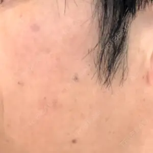 ミニマムスキンクリニック ミニマムスキンクリニック池袋口コミ