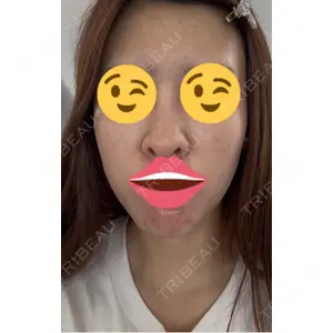 L‘amour clinic Tokyo【ラムールクリニック東京】口コミ