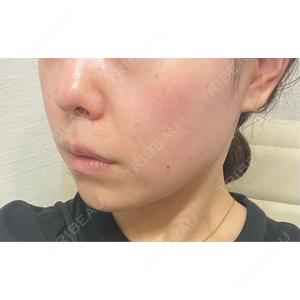 東京美容外科 東京美容外科 池袋院口コミ