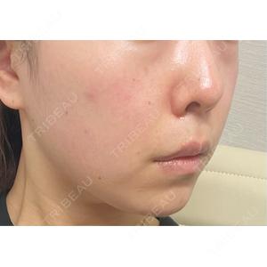 東京美容外科 東京美容外科 池袋院口コミ