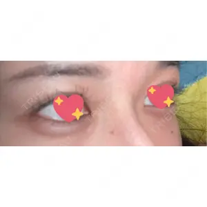 フィラークリニック フィラークリニック 名古屋栄院口コミ