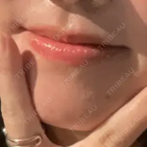 プライベートスキンクリニック 梅田本院口コミ