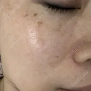 A CLINIC（エークリニック） A CLINIC（エークリニック） 銀座院口コミ