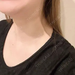 APスキンクリニック銀座口コミ