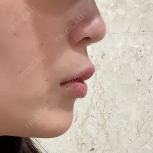 口コミ