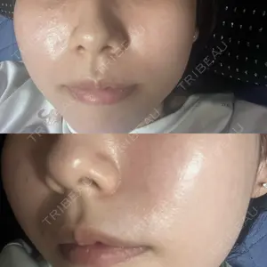 クレオビューティークリニック口コミ