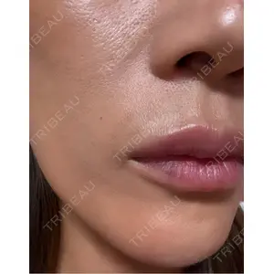 HAAB×DREAM BEAUTY CLINIC HAAB BEAUTY CLINIC 名古屋院口コミ