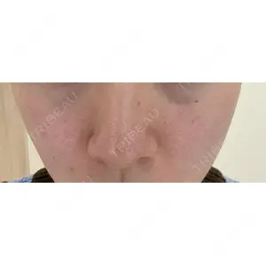 ミニマムスキンクリニック ミニマムスキンクリニック池袋口コミ