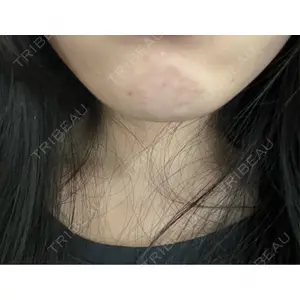 ルラ美容クリニック ルラ美容クリニック 千葉院 / ルラスキンクリニック 千葉院口コミ