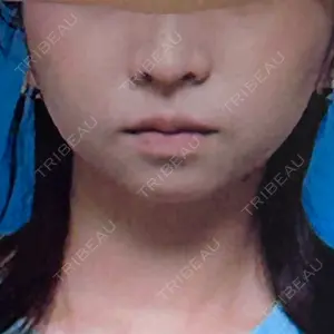 東京ココセランクリニック口コミ