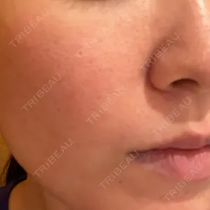 東京素肌クリニック 東京素肌クリニック 銀座本院口コミ