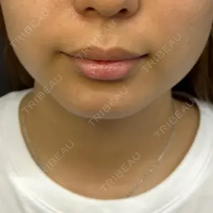 ルラ美容クリニック 渋谷本院の