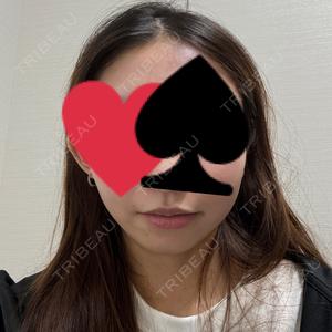 東京美容外科 東京美容外科 池袋院口コミ