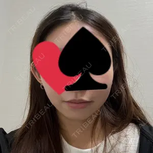 APスキンクリニック銀座口コミ