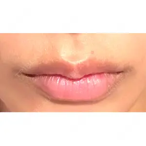 新未来クリニック口コミ