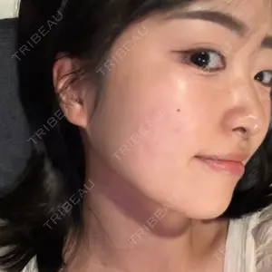 ルラ美容クリニック ルラ美容クリニック 池袋院口コミ