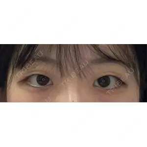 MIYAフェイスクリニック口コミ