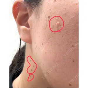 PureMe Skin Clinic（ピュアミースキンクリニック麻布）口コミ