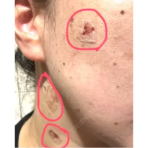 PureMe Skin Clinic（ピュアミースキンクリニック麻布）口コミ