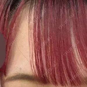 グランジョイクリニック口コミ