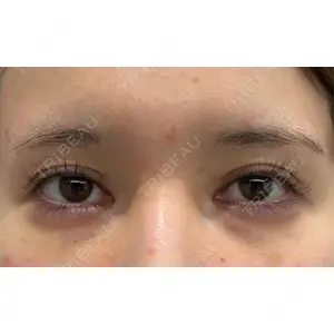 BIANCA CLINIC BIANCA銀座口コミ