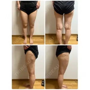 湘南美容クリニック 湘南美容クリニック 新橋銀座口院口コミ