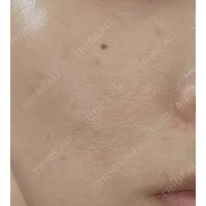 ルラ美容クリニック ルラ美容クリニック 名古屋栄院 / ルラスキンクリニック 名古屋栄院口コミ