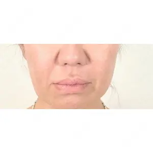 アリエル美容クリニック アリエル美容クリニック 横浜院口コミ